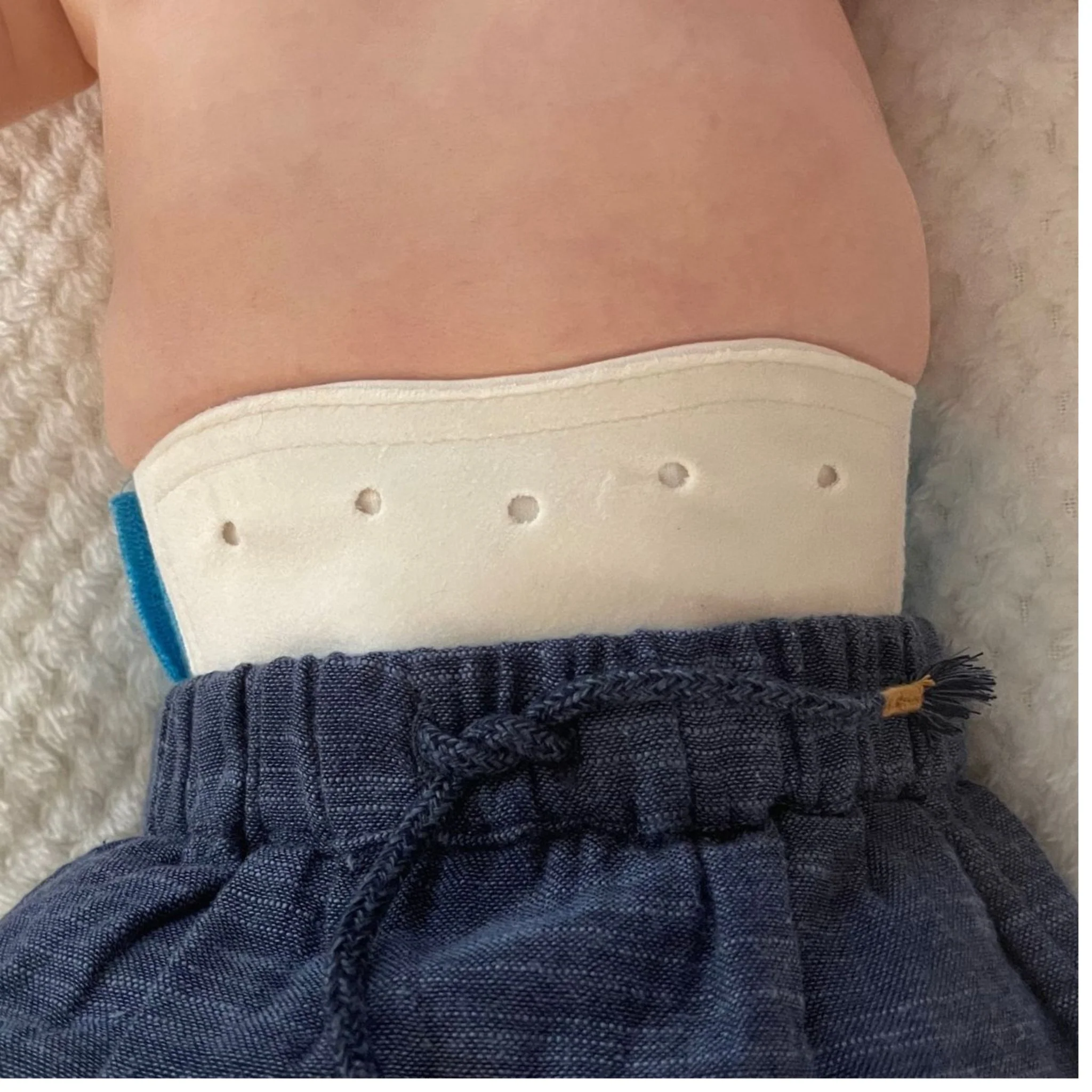 Baby Hernia Belt - Image 4